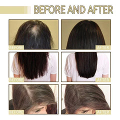 Anti Hair Loss Scalp Treatment Serum