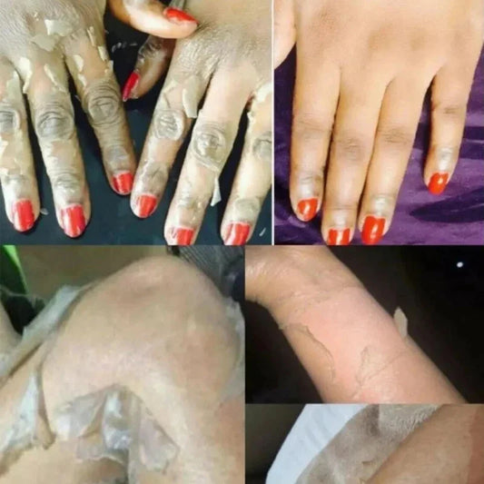 Strong Yellow Peeling Oil