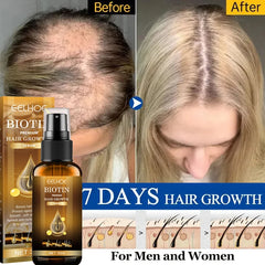 Fast Hair Growth Anti-Hair Loss Serum Spray