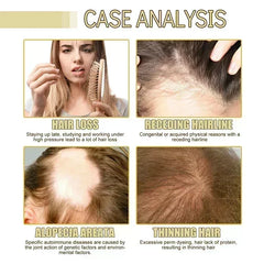 Anti Hair Loss Scalp Treatment Serum