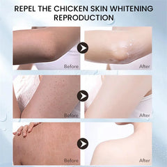 Keratosis Pilaris Repair Cream